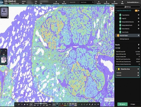 Indica Labs Rolls Out AI-Powered Macrodissection Suite to Advance Molecular Pathology Workflows