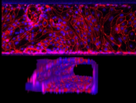 The Dutch company MIMETAS expanded its license to the HUB Organoid Technology to include all organs